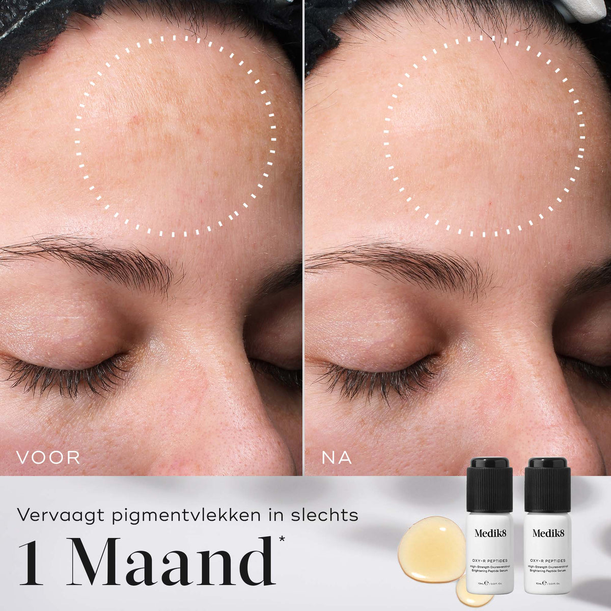 Medik8 Oxy-R Peptides 2x 10ml risultato prima e dopo