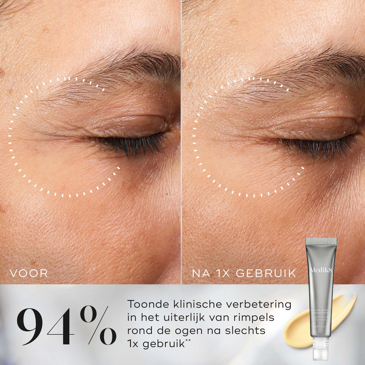Medik8 Crystal Retinal Ceramide Eye 10 15ml risultato prima e dopo