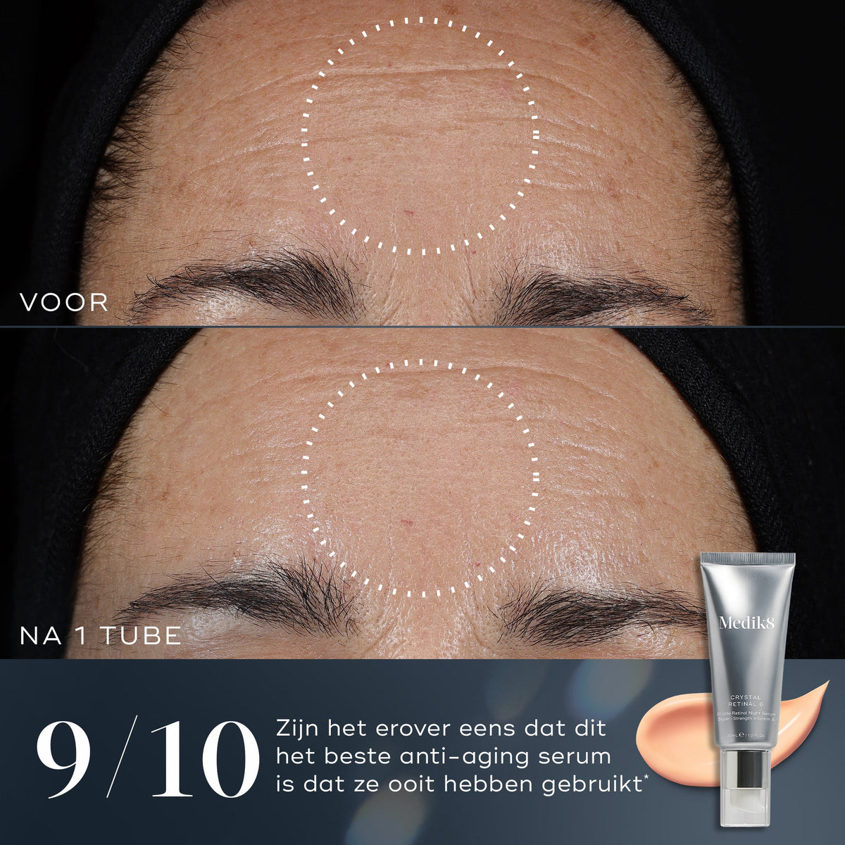 Medik8 Crystal Retinal 3 30ml prima e dopo: meno linee sottili