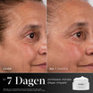 Medik8 Advanced Pro Collagen+ Peptide Cream 50ml risultato prima e dopo