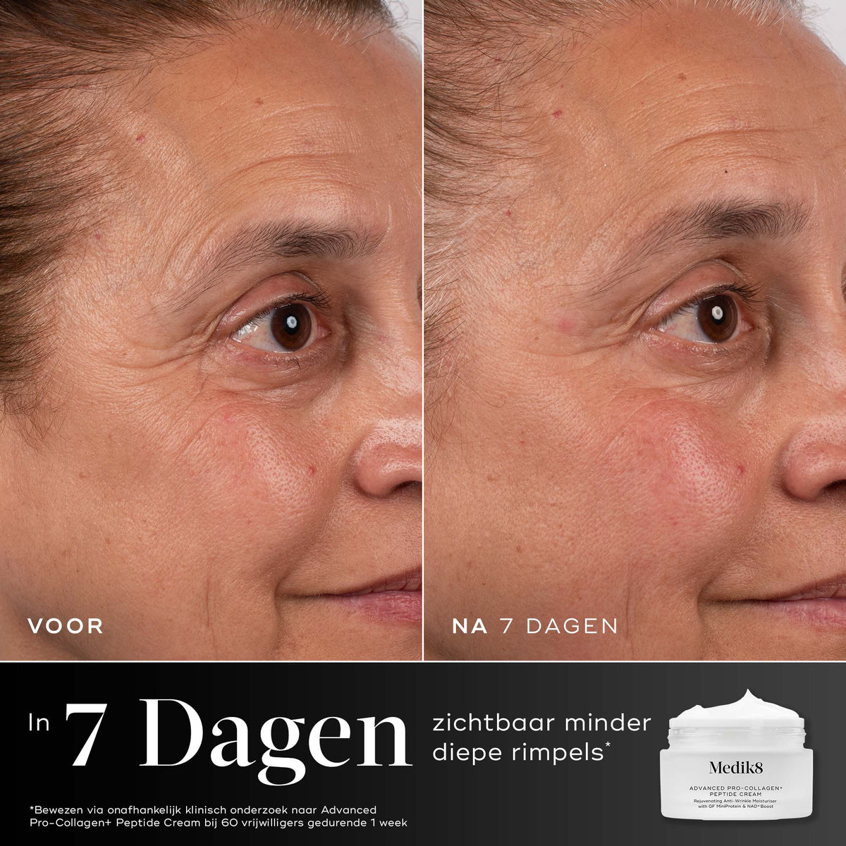 Medik8 Advanced Pro Collagen+ Peptide Cream 50ml risultato prima e dopo
