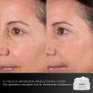 Medik8 Advanced Pro Collagen+ Refill 50ml risultato prima e dopo due