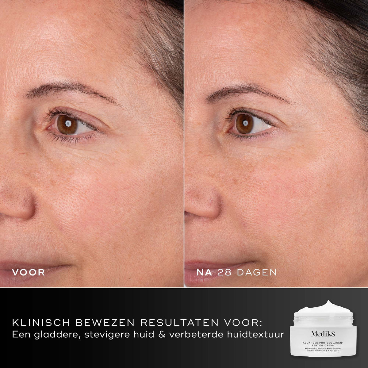 Medik8 Advanced Pro Collagen+ Refill 50ml risultato prima e dopo due