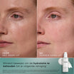 Medik8 Total Moisture Cleansing Gel 145ml risultato prima e dopo