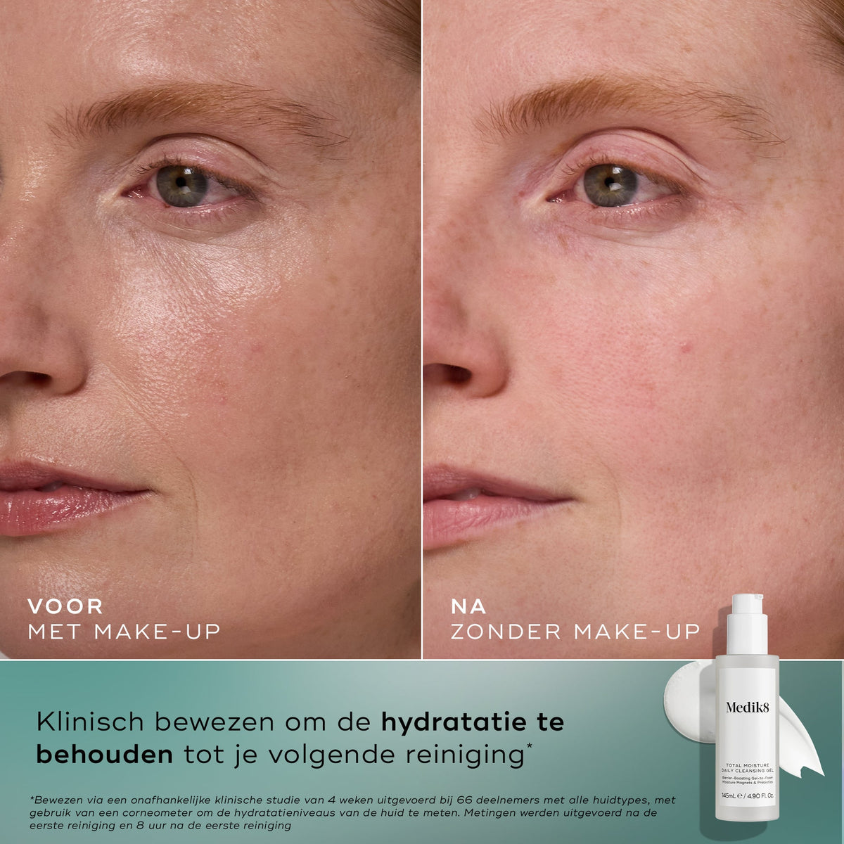 Medik8 Total Moisture Cleansing Gel 145ml risultato prima e dopo