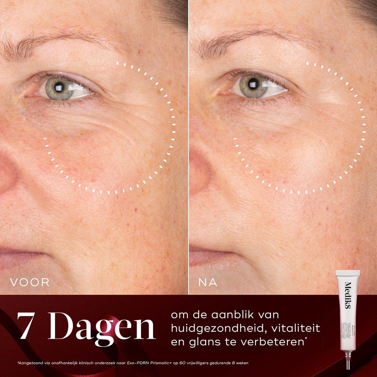 Medik8 Rejuvenation Routine Exo-PDRN Prismatic+ risultato prima e dopo