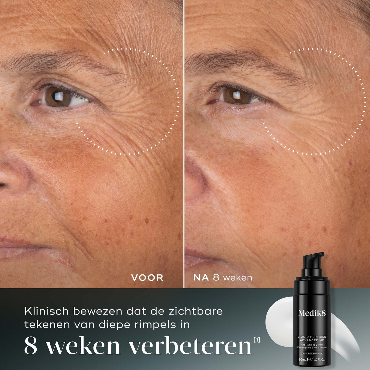 Medik8 Liquid Peptides Advanced MP 30ml risultato prima e dopo