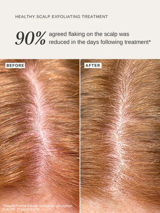 Alpha-H Healthy Scalp Exfoliating Treatment sfeer2