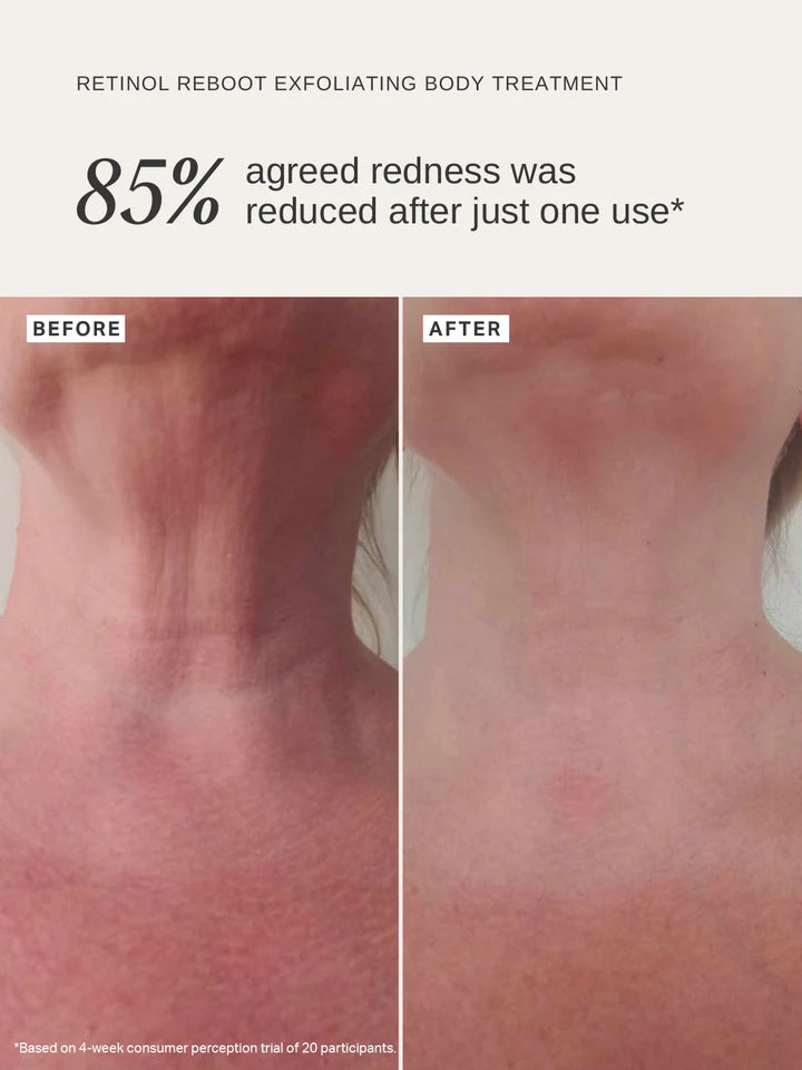 Retinol Reboot Exfoliating Body Treatment 120ml | Alpha-H