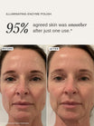 Alpha-H Illuminating Enzyme Polish before and after