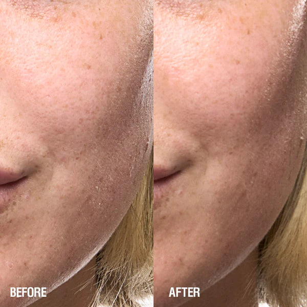 Grown Alchemist Skin Renewal Serum prima e dopo