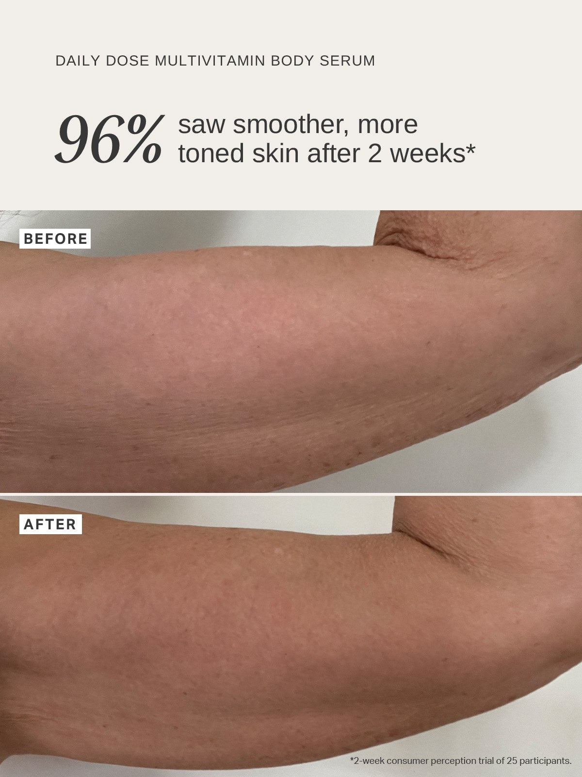Alpha-H Daily Dose Multi-Vitamin Glow Body Serum braccio prima e dopo