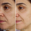 Alpha-H High Tide Water Cream prima e dopo risultato due