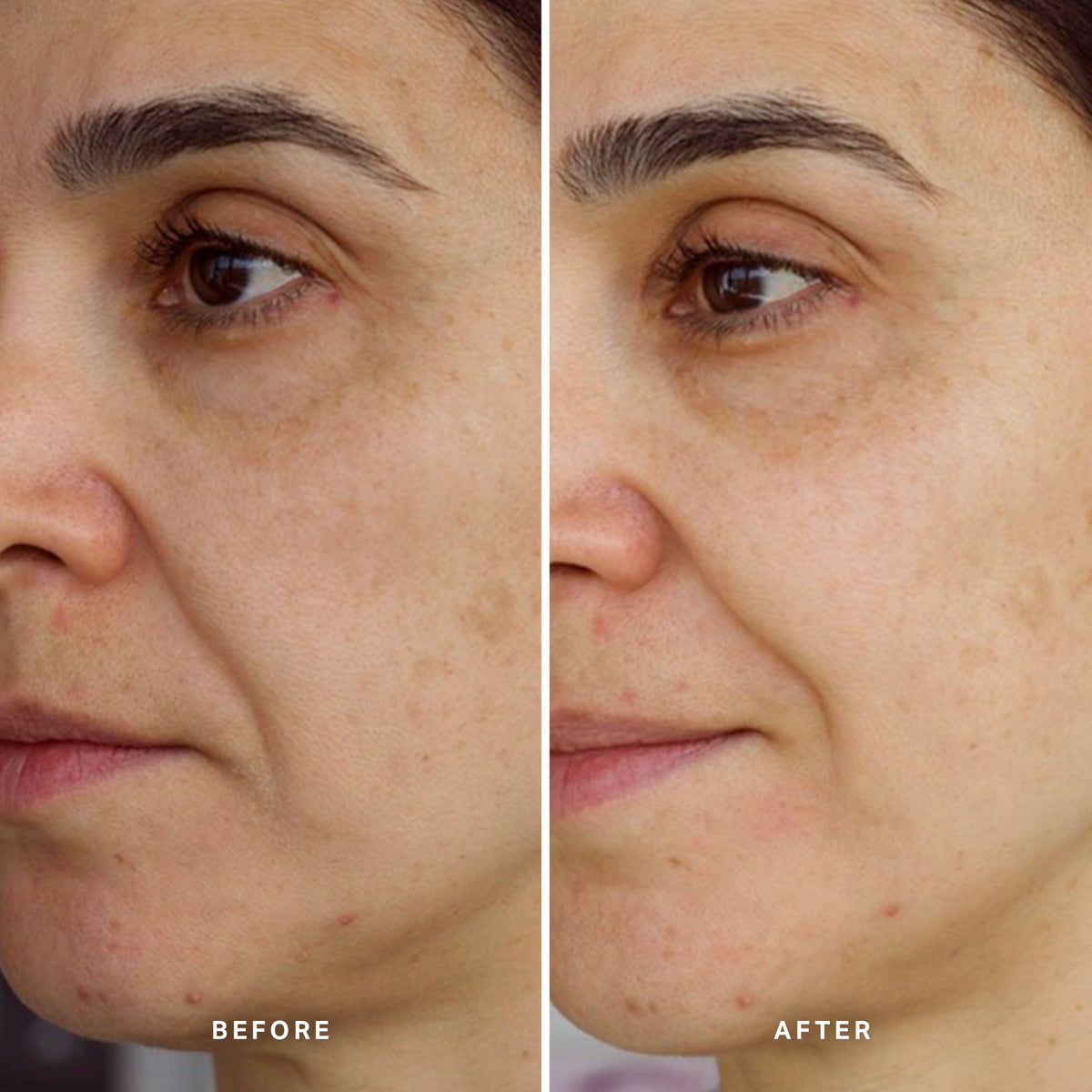 Alpha-H High Tide Water Cream prima e dopo risultato due