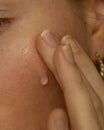 Alpha-H Instant Action BHA Blemish Treatment applicato su un brufolo