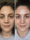 Alpha-H Liquid Gold Exfoliating Treatment prima e dopo risultato due