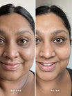 Alpha-H Liquid Gold Exfoliating Treatment prima e dopo risultato quattro