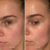 Alpha-H Midnight Reboot Serum prima e dopo risultato tre