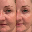 Alpha-H Midnight Reboot Serum prima e dopo risultato due