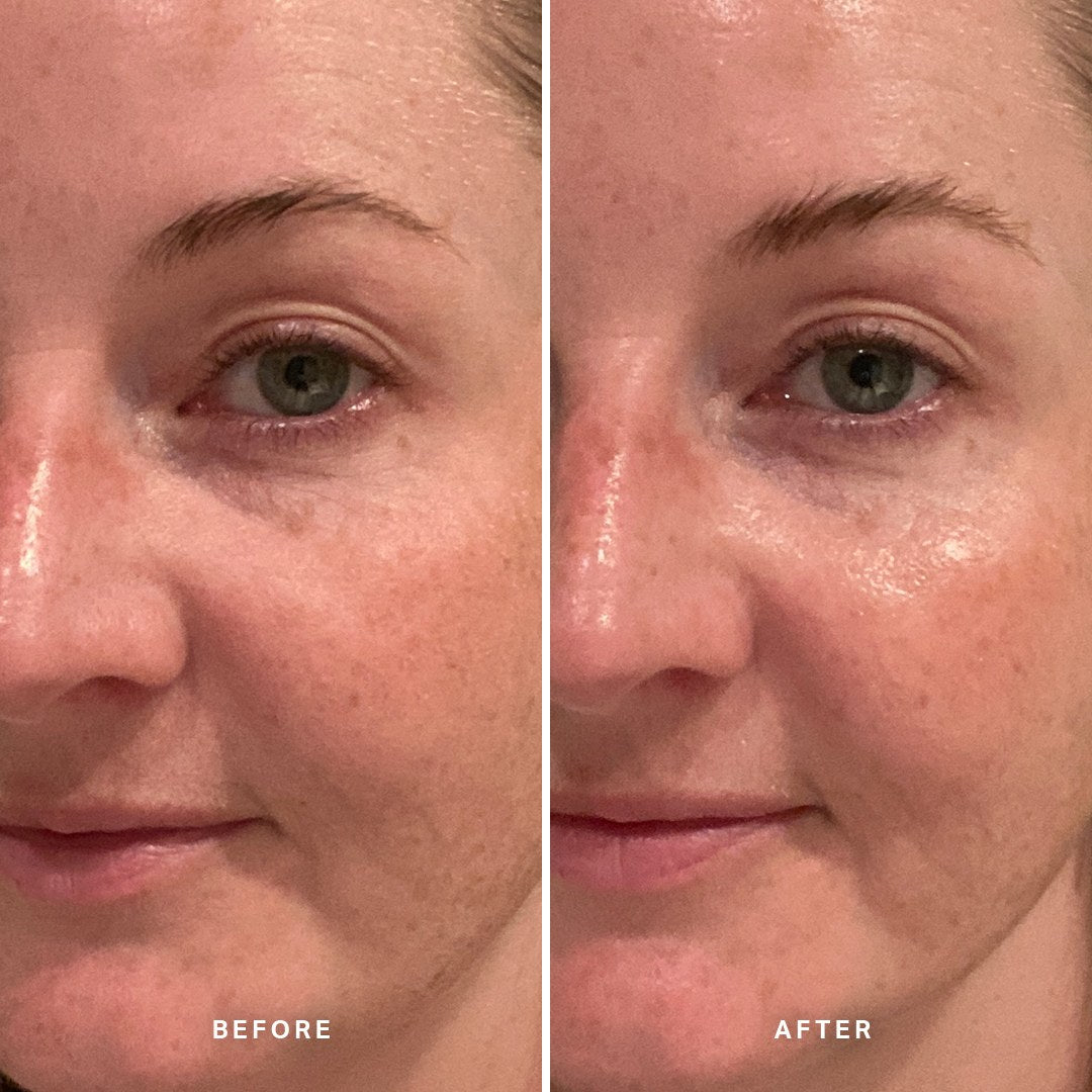 Alpha-H Midnight Reboot Serum prima e dopo risultato due