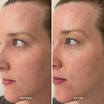Alpha-H Midnight Reboot Serum prima e dopo risultato quattro