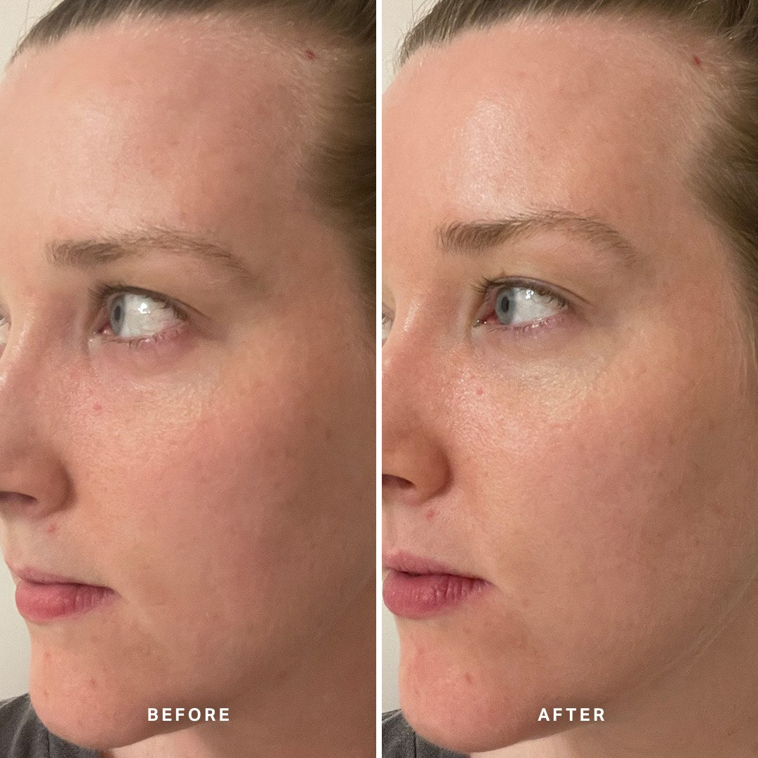 Alpha-H Midnight Reboot Serum prima e dopo risultato quattro