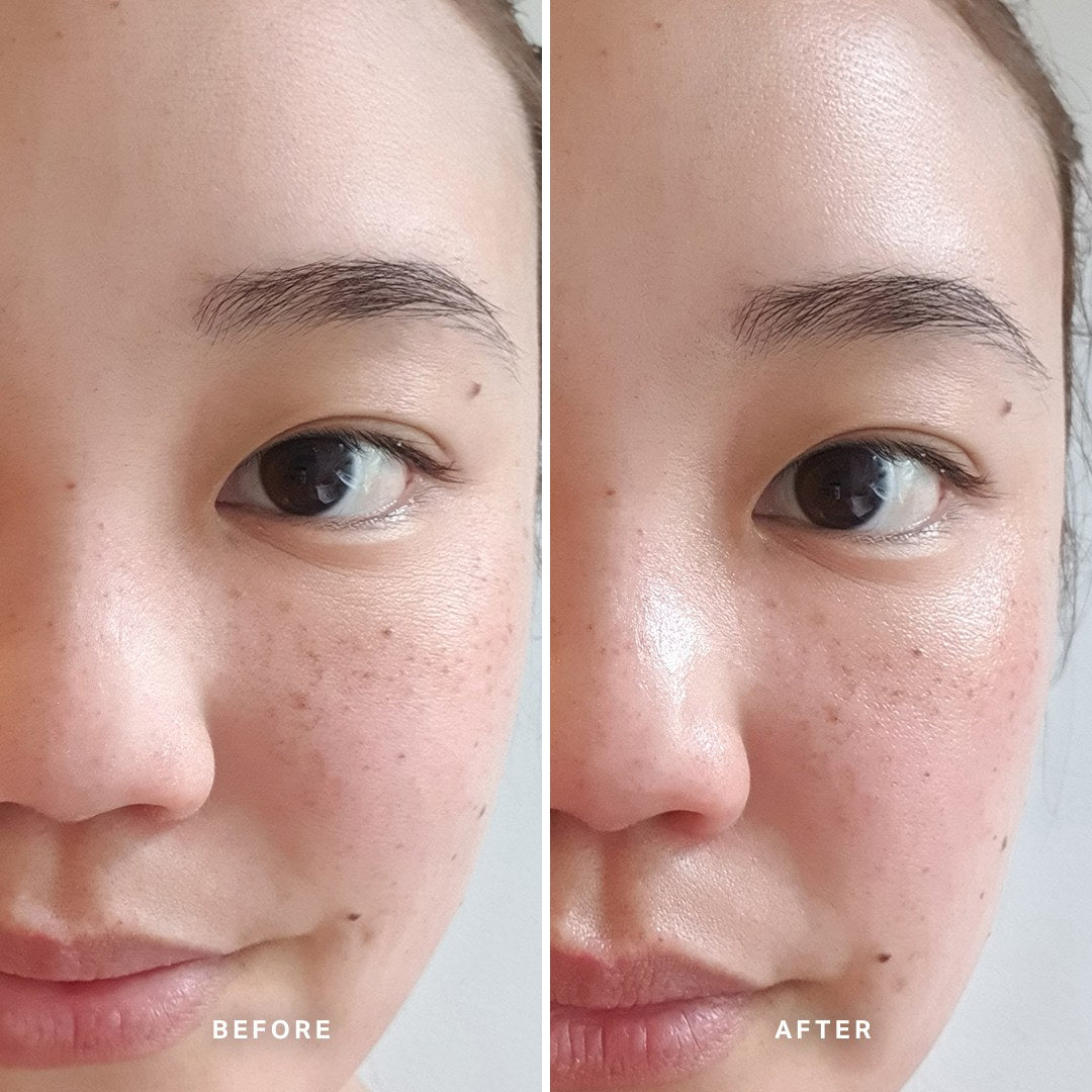 Alpha-H Midnight Reboot Serum prima e dopo risultato cinque