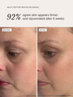 Alpha-H Multi-Peptide Revitalise Serum prima e dopo risultato tre