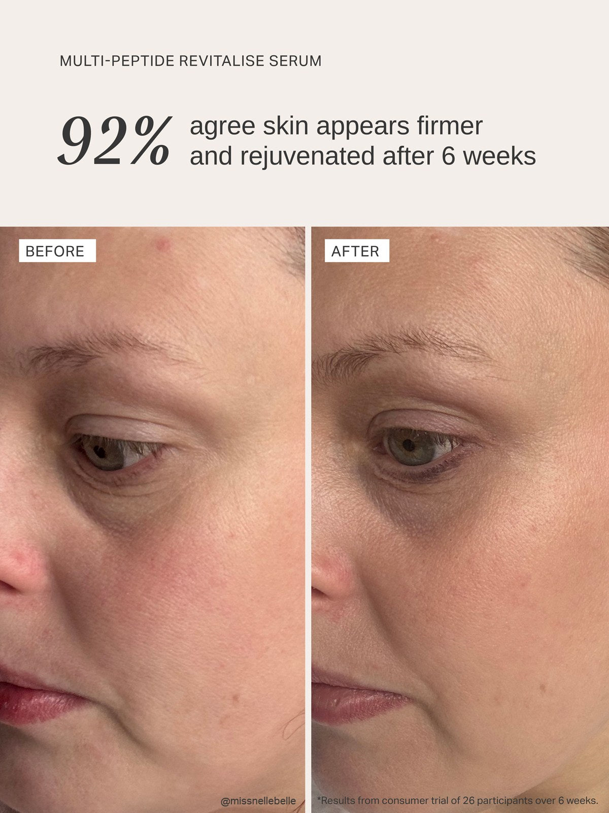 Alpha-H Multi-Peptide Revitalise Serum prima e dopo risultato tre