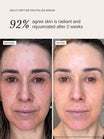 Alpha-H Multi-Peptide Revitalise Serum prima e dopo risultato due
