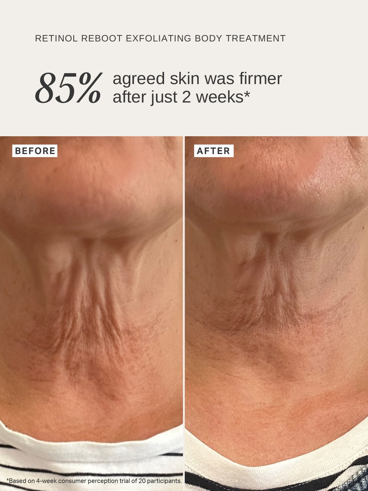 Alpha-H Retinol Reboot Exfoliating Body Treatment prima e dopo pelle più tonica