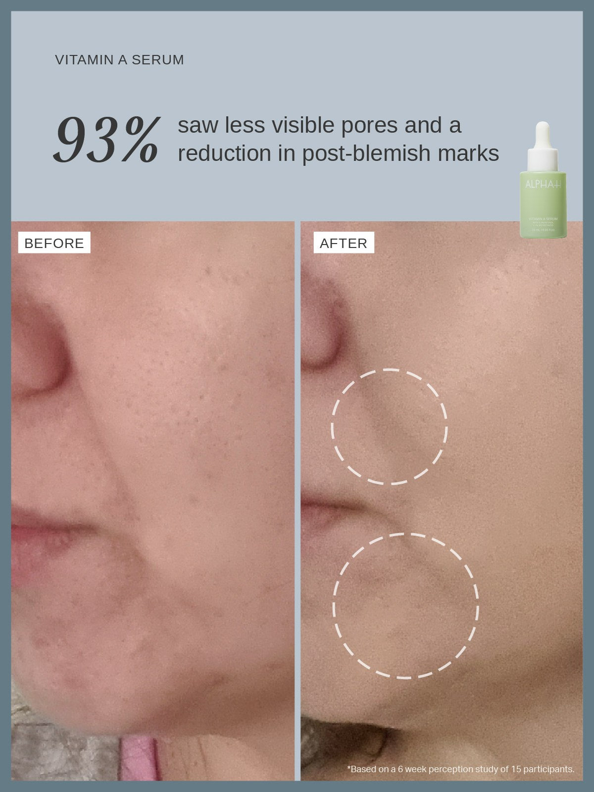 Alpha-H Vitamin A Serum prima e dopo pori meno visibili