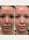 Alpha-H Vitamin B Serum prima e dopo risultato tre