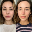 Alpha-H Vitamin C Serum prima e dopo risultato due