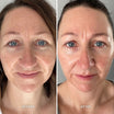 Alpha-H Vitamin E Serum risultato prima e dopo