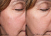 Medik8 r-Retinoate Intense - Night cream prima e dopo