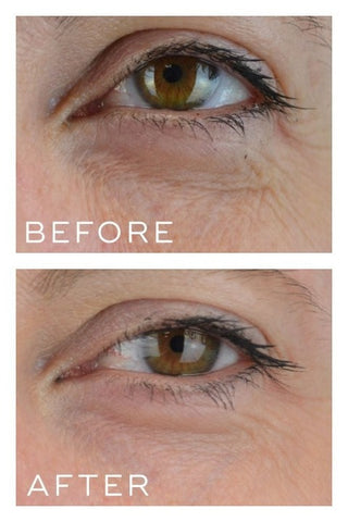 Medik8 Crystal Retinal 3 30ml effect