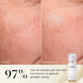 Press & Glow Refill 200ml | Medik8