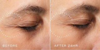 Medik8 Crystal Retinal Ceramide Eye 6 15ml effect