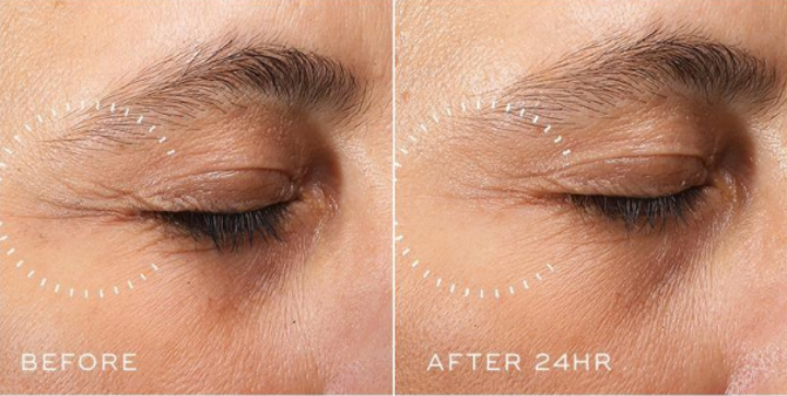 Medik8 Crystal Retinal Ceramide Eye 3 15ml effect